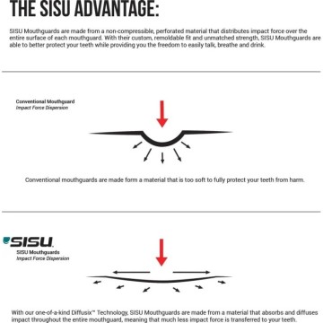 Sisu Next Gen Max Mouth Guard (One Size|Hot Pink)