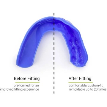 Sisu 3D Mouth Guard (One Size|Intense Red)